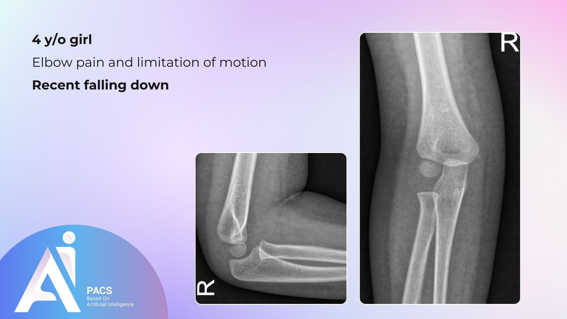 Radiology Cases: Understanding Diagnostic Imaging